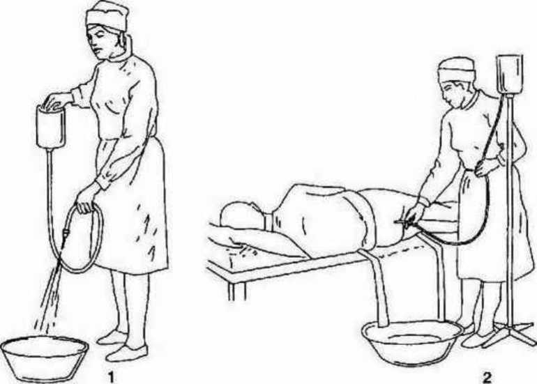 Проведение очистительной клизмы